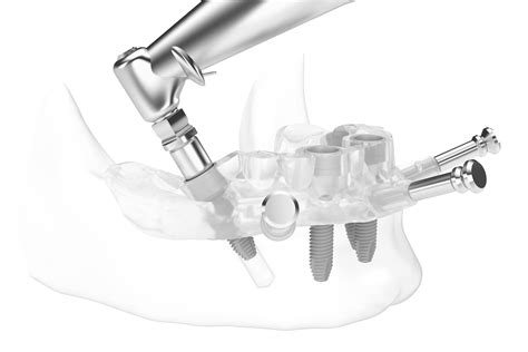 advanced implant dental courses